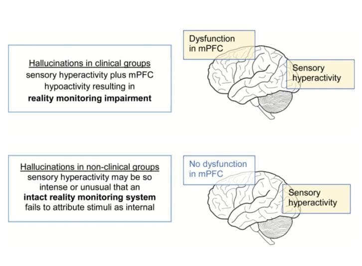 Paracingulate Sulcus Morphology and Hallucinations in Clinical and Nonclinical Groups (Garrison et al, 2019)